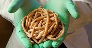 parasites extraits du corps humain