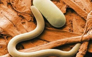 types de parasites de contact dans le corps humain