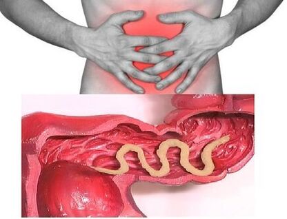 les signes d'helminthiase chronique sont un trouble dyspeptique de l'intestin
