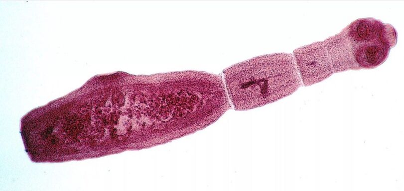 L'échinocoque est l'un des parasites les plus dangereux pour l'homme
