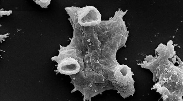 Negleria fowlera est un parasite protozoaire dangereux pour la vie humaine. 
