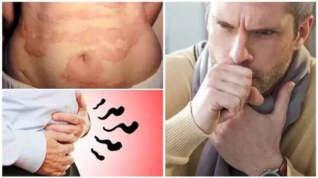 Les allergies, la toux et les ballonnements sont des signes de dommages causés au corps par les vers
