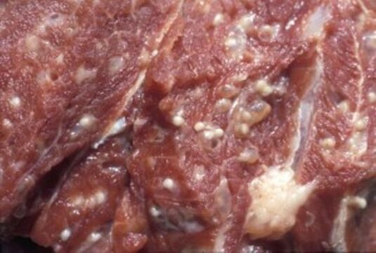 Viande contaminée par Trichinella - parasites dangereux